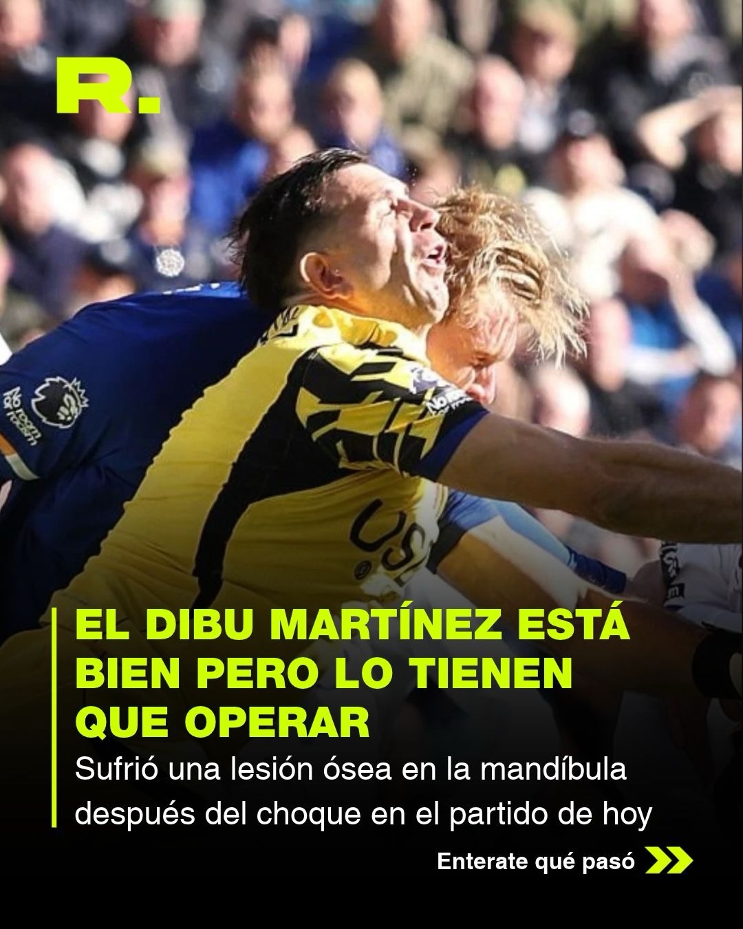 🇦🇷 El DIBU LESIONADO (1/3)