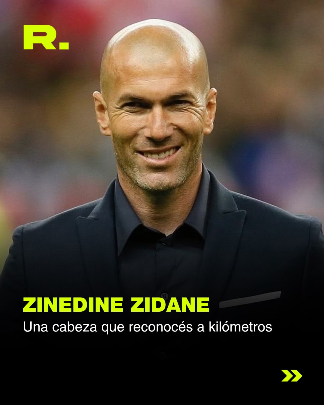 🧑🏻🦲ES EL DÍA MUNDIAL DE LOS PELADOS (18/20)