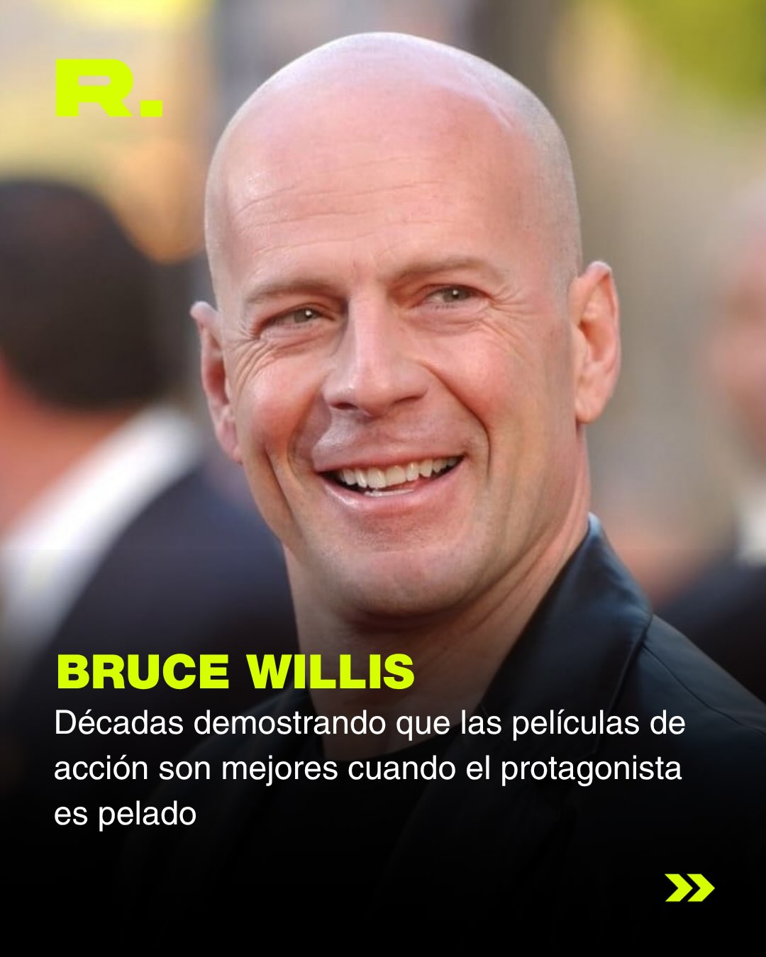 🧑🏻🦲ES EL DÍA MUNDIAL DE LOS PELADOS (15/20)