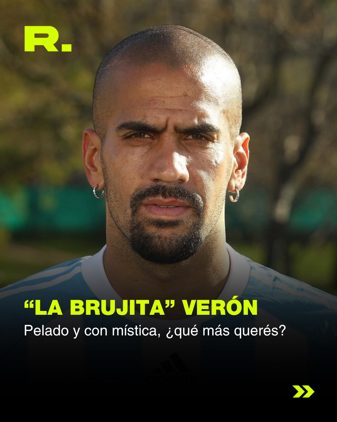 🧑🏻🦲ES EL DÍA MUNDIAL DE LOS PELADOS (19/20)